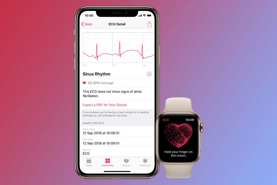 Apple Watch 7 jsou ideální pro uživatele s bradykardií, tachykardií či jinými srdečními chorobami, neboť dokáží vygenerovat elektrokardiogram podobný jednosvodovému EKG.